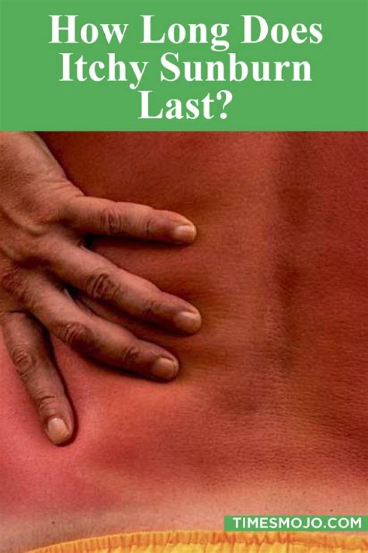 How long does Itchy last?
